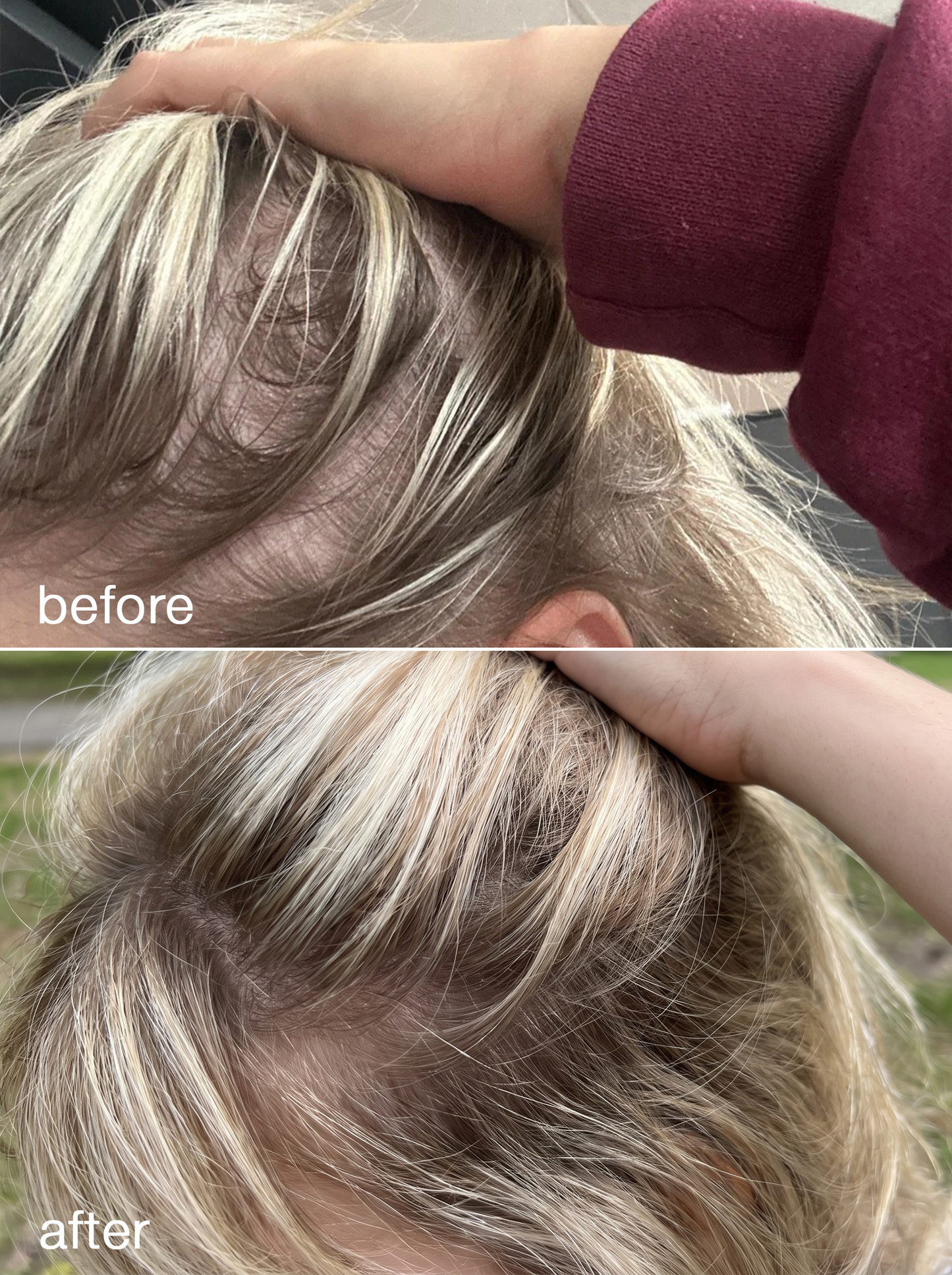 Hair Growth Serum