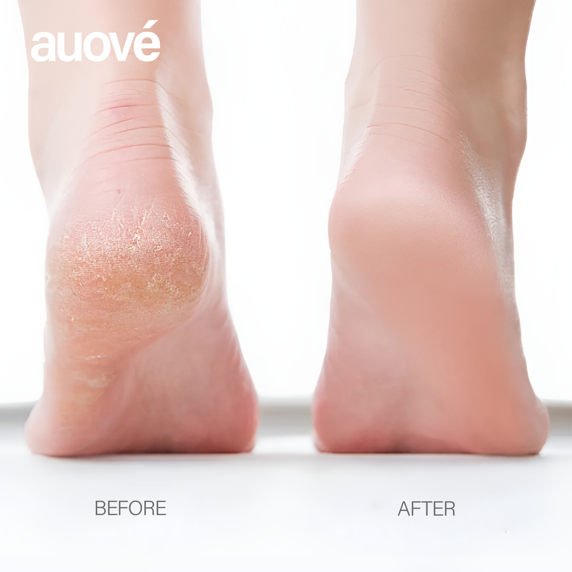 Auové Flawless Pro