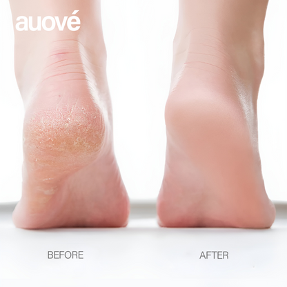 Auové Flawless Pro