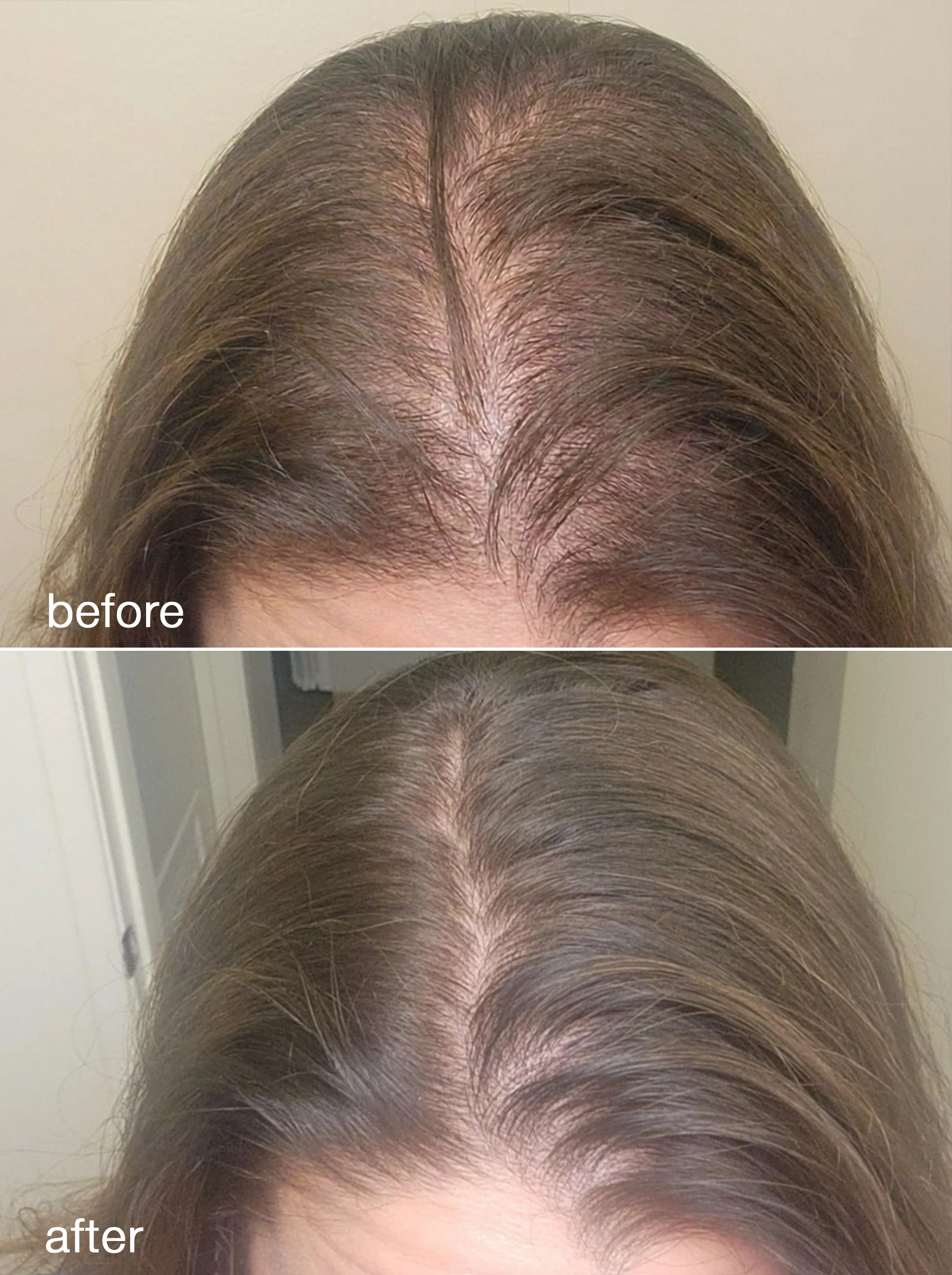 Hair Growth Serum
