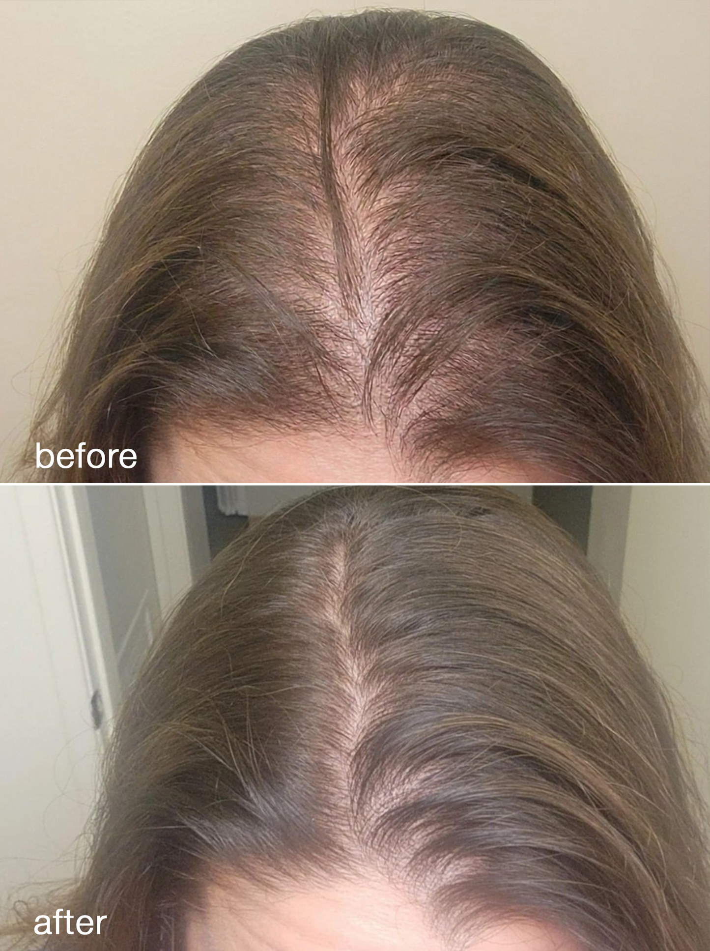 Hair Growth Serum